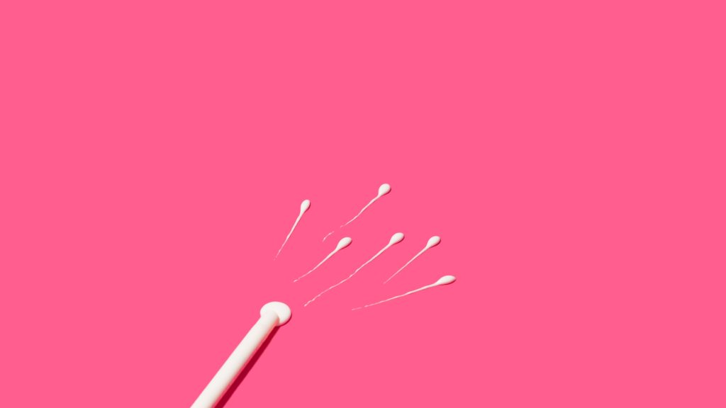 Espermatozoides siendo introducidos en el útero durante un tratamiento de inseminación artificial (IA).