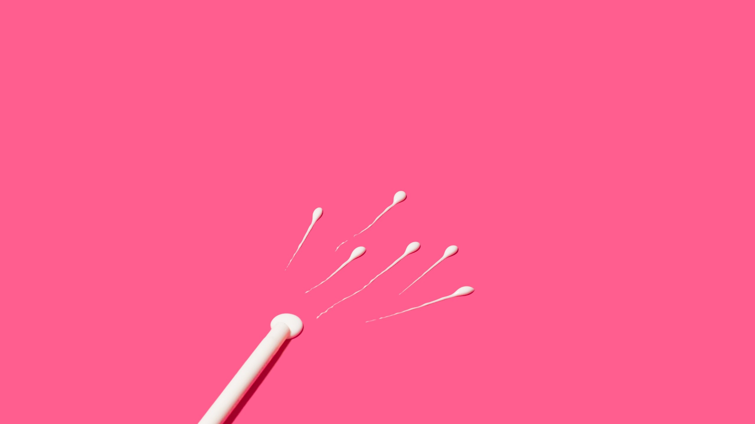 Espermatozoides siendo introducidos en el útero durante un tratamiento de inseminación artificial (IA).